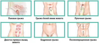 Книга Клиническая анатомия стенок брюшной полости.Грыжи живота •  Гайворонский И.В. - купить по цене 425 руб. в интернет-магазине  Inet-kniga.ru | ISBN 978-5-29901-083-1