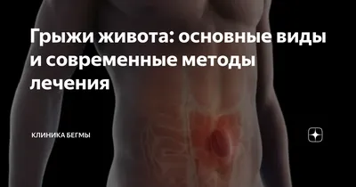 Удаление и лечение грыжи в Ярославле: пупочной, послеоперационной, паховой,  бедренной, и грыжи белой линии живота | Стоимость операции грыжесечения