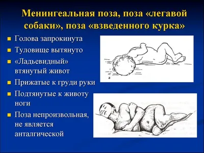 Менингококковая инфекция - online presentation