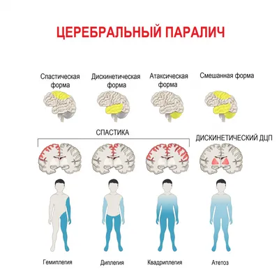 Если крысе не давать спать, она умрёт через 3 недели — как работают мозг и  сон / Хабр