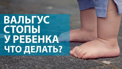 Клиника Бобыря - Плоскостопие опаснее, чем принято считать Плоскостопие -  это уплощение свода стопы. В норме стопа человека при взгляде на нее сбоку  похожа на арку, которую формируют поперечный и продольный своды.