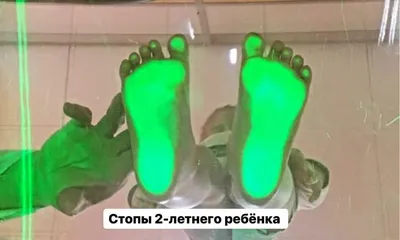 Этапы развития стопы ребёнка.