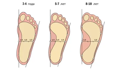 Плоскостопие у ребенка? Мы знаем решение! | BubaGO - для мам и малышей |  Дзен