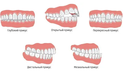 Правильный прикус у человека: фото зубов | Dental Art