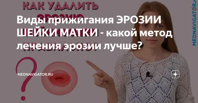 Лазерная коагуляция шейки матки - лечение эрозии шейки матки лазером в  Киеве | Клиника Gold Lase