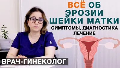 Лечение эрозии и дисплазии шейки матки во Львове | Цены | Клиника  Альтернатива