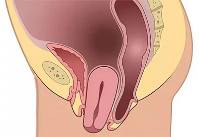 Женская мочевая инконтиненция. Классификация и диагностика.