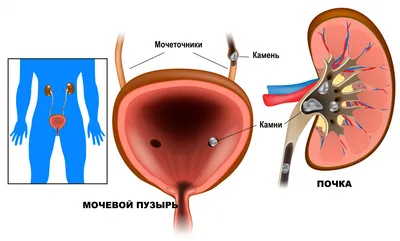 Иллюстрация 1 из 7 для Пролапс тазовых органов у женщин. Пособие для врачей  - Коршунов, Сазыкина |