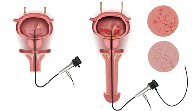 Development of a Uterosacral Ligament Suspension Rat Model | Protocol  (Translated to Russian)