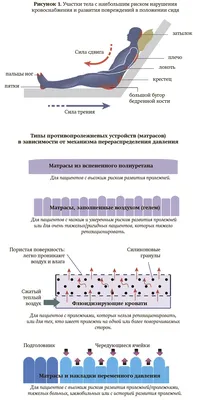 Профилактика пролежней у лежачих больных. Услуги лечения пролежней в  пансионатах Подмосковья