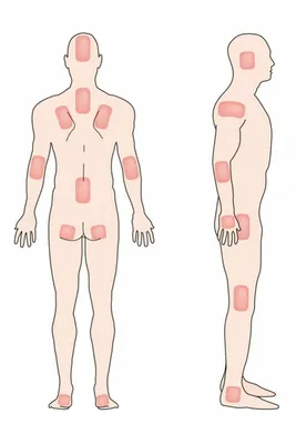 Blog | Уход и лечение пролежней