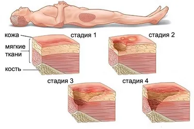 Бюгельный протез зубов – цена на верхнюю и нижнюю челюсть, фото, отзывы