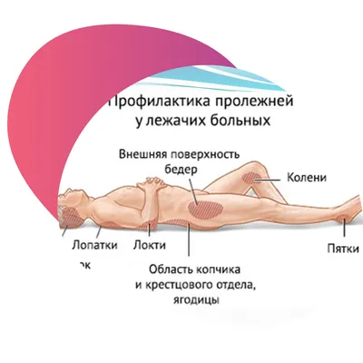 Профилактика и обработка пролежней у пожилых лежачих больных в пансионатах  Забота о близких