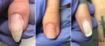 Пропил ногтя при аппаратном маникюре фото фотографии