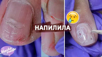 Пропилы ногтевой пластины. Причина чтобы сменить мастера маникюра. |  ВКонтакте