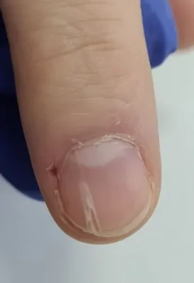 Ужасные пропилы.Как не сделать пропил/Как делать маникюр на ногте с  пропилом - YouTube