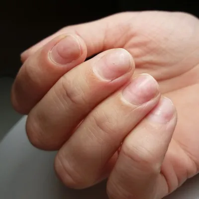 Покалеченные ногти после маникюра 🤯 | VIKOLA beauty | Дзен