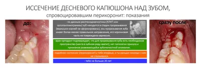 Что делать когда режутся зубы у детей? ▶️Eurodent.kz