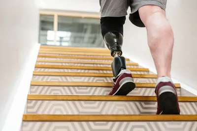 Салют Орто: бионический протез с коленным модулем Steplife