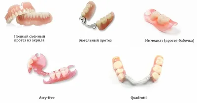 Протезирование зубов - виды и особенности, материалы для протезирования |  НоваДент