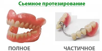 Протезирование зубов в Омске. Цены на протезирование зубов в 2023 году в  стоматологии АлексДент