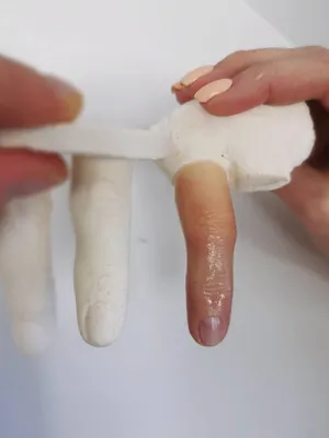 Протезы пальцев | Пикабу