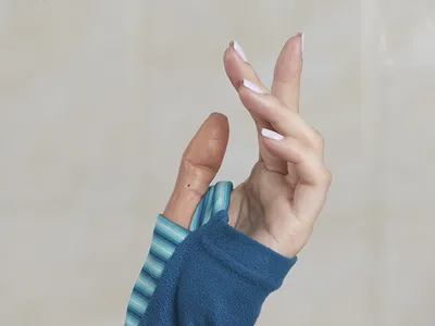 Силиконовый палец: протезы пальцев рук и ног ➤➤Эпитетика