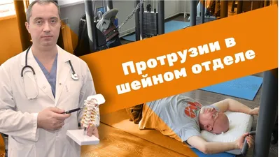 Грыжи и протрузии шейного отдела позвоночника. Обострение [ЛФК] - YouTube