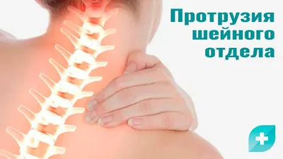 Протрузия шейного отдела симптомы