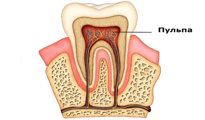 Что такое пульпит? | WhiteLine