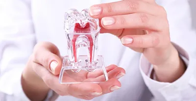 Пульпит (зуба): симптомы, лечение в Иркутске в Клинике Эксперт