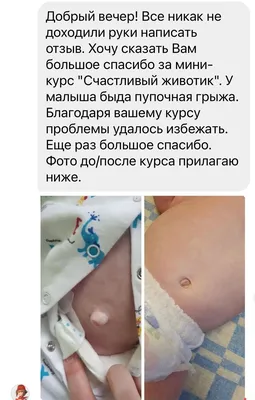 https://newlifeclinic.kiev.ua/hirurgiya-pupochnyh-gryzh