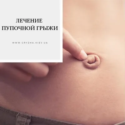 Абдоминопластика или жизнь после родов - Курбанова Зарема Вахаевна