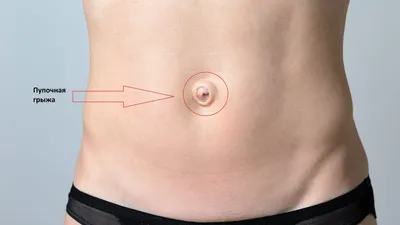 Абдоминопластика, ушивание диастаза прямых мышц живота, операция — в VIP  Clinic, цены в Москве. Операция по устранению диастаза, пластика белой  линии живота, передней стенки живота у мужчин, у женщин после родов.  Стоимость