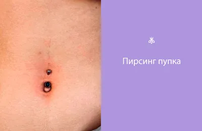 Уход за пупком новорожденного: сколько заживает и как обрабатывать ранку