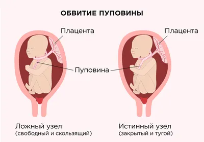 Как определить пол щенка и отличить мальчика от девочки у собак