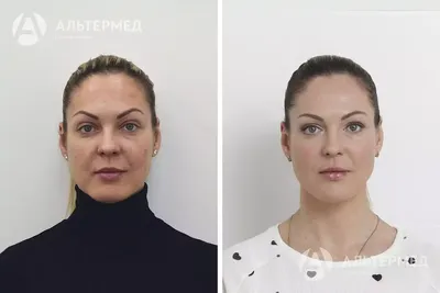 Препарат Радиесс: характеристики и преимущества