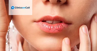 Протоколы лечения рака губы 2022 за рубежом - Clinics on Call