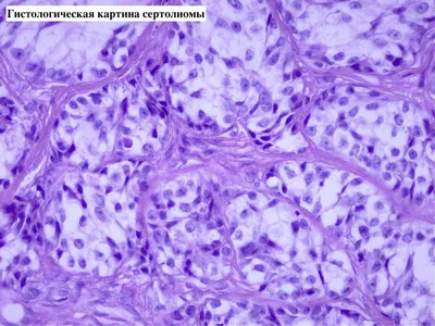 Опухоли у кошек и собак — Ветеринарный центр доктора Новичихиной А.В. в  Череповце