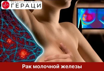 МОРФОЛОГИЧЕСКАЯ ДИАГНОСТИКА ОПУХОЛЕЙ МОЛОЧНЫХ ЖЕЛЕЗ У СОБАК – тема научной  статьи по ветеринарным наукам читайте бесплатно текст  научно-исследовательской работы в электронной библиотеке КиберЛенинка