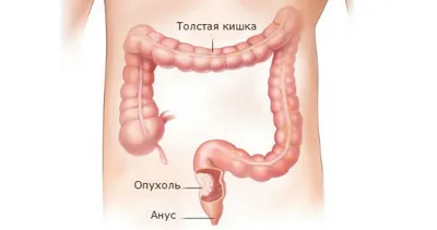 Энтерит, гастрит, панкреатит, запор и другие проблемы пищеварения у собак |  Hill's Pet