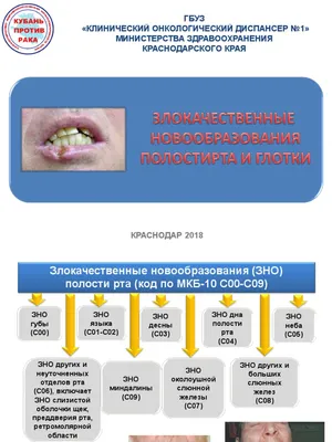 Лейкоплакия Полости Рта-Симптомы Лечение