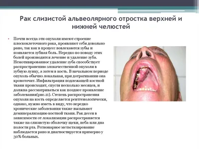Опухоли ротовой полости у собак и кошек: лечение, диагностика, фото