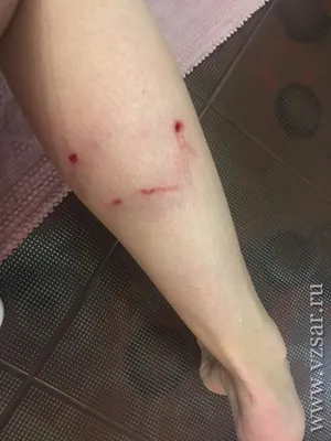 Рана укуса собаки стоковое фото. изображение насчитывающей внимательность -  63785988