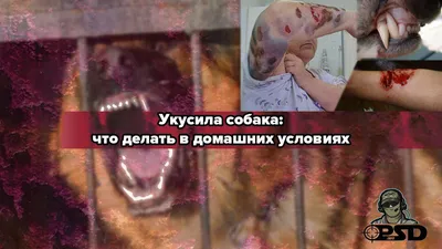 В Роспотребнадзоре подсчитали число пострадавших от укусов животных россиян  - ТАСС