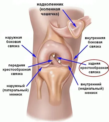Артроскопия коленного сустава. Разрыв ПКС