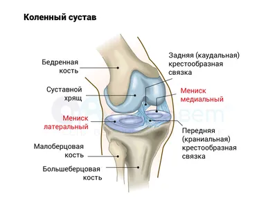 Повреждение менисков (наружного, внутреннего), разрыв/повреждение  крестообразных связок коленного сустава: симптомы, операция, восстановление  – НКЦ №2 (ЦКБ РАН)