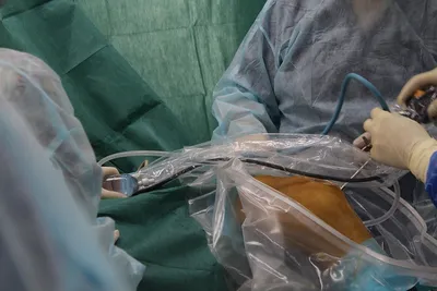 Артроскопическая пластика передней крестообразной связки коленного сустава,  низкие цены на операцию в Москве в центре Открытая Клиника