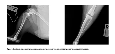 Разрыв передней крестообразной связки | Миленин Олег Николаевич | Москва