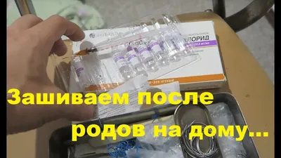 Жесть!! Зашивание разрывов промежности после родов в домашних условиях. Как  делают и нужен ли наркоз - YouTube